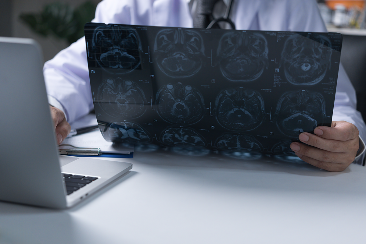 Arzt schaut sich die Röntgenbilder an und notiert sich am Laptop die Diagnose